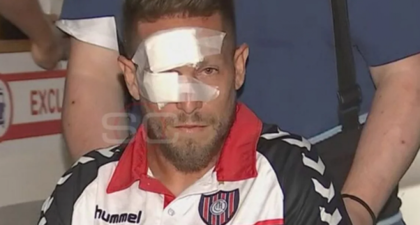 ASÍ ABANDONABA EL HOSPITAL EL JUGADOR DE CHACARITA AGREDIDO POR UN BOTELLAZO POR LA HINCHADA DE TIGRE