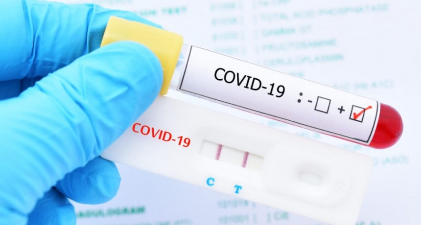 FUERTE SALTO EN EL NÚMERO DE CONTAGIOS: 12.936 EN LAS ÚLTIMAS 24 HORAS