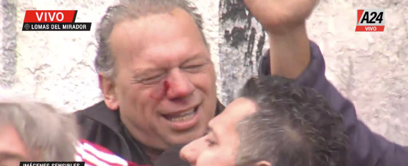 BERNI FUE GOLPEADO EN LA PROTESTA DE CHOFERES