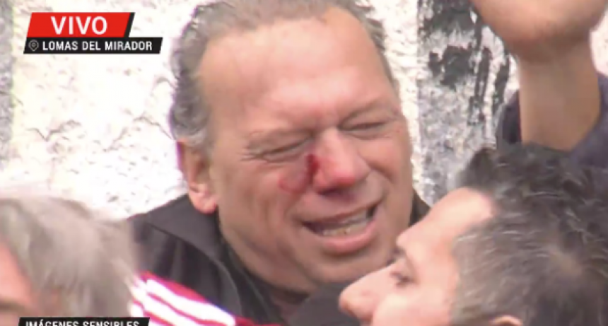 BERNI FUE GOLPEADO EN LA PROTESTA DE CHOFERES