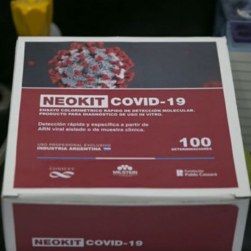 CIENTÍFICOS ARGENTINOS DESARROLLARON TEST PARA DETECTAR EL CORONAVIRUS.