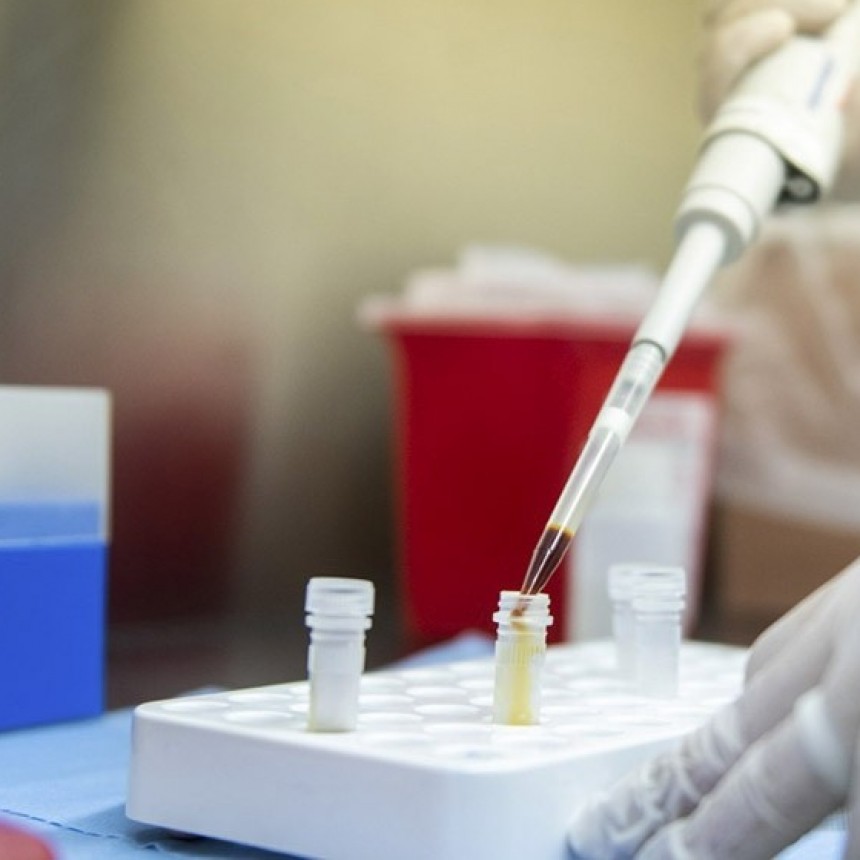 SE REALIZAN PRUEBAS PILOTO DE TESTEOS GRUPALES DE CORONAVIRUS EN BUENOS AIRES