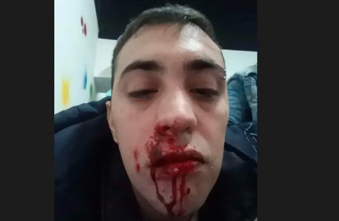 BRUTAL GOLPIZA DE HINCHAS DE ESTUDIANTES A UN JOVEN DE GIMNASIA EN PLENA CALLE