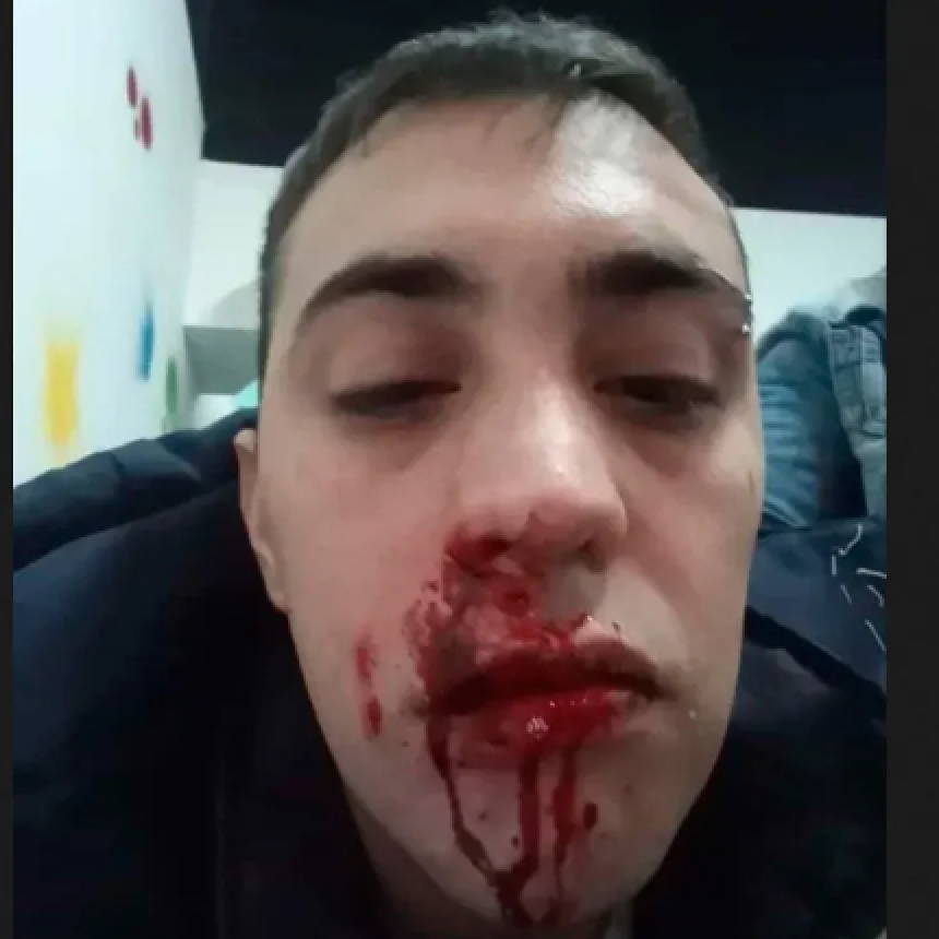 BRUTAL GOLPIZA DE HINCHAS DE ESTUDIANTES A UN JOVEN DE GIMNASIA EN PLENA CALLE
