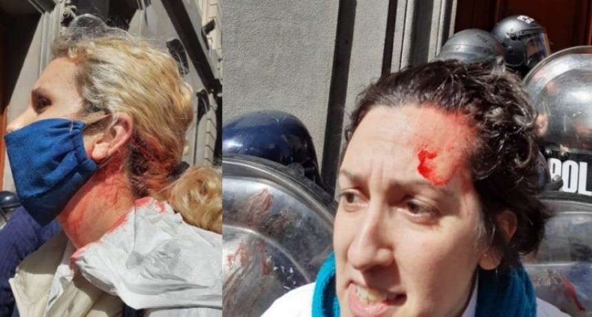 INCREIBLE PERO REAL: LA POLICÍA DE LA CIUDAD REPRIMIÓ A ENFERMEROS Y ENFERMERAS