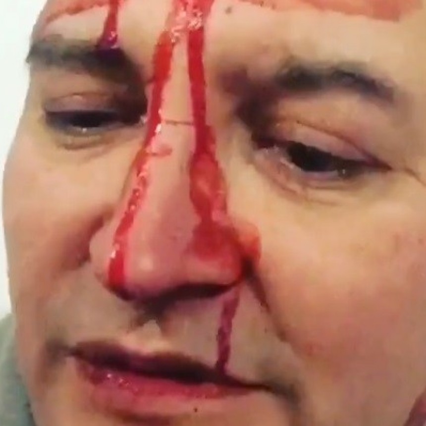 EL MÚSICO LEO GARCÍA SUFRIÓ UN ATAQUE HOMOFÓBICO EN GENERAL RODRÍGUEZ
