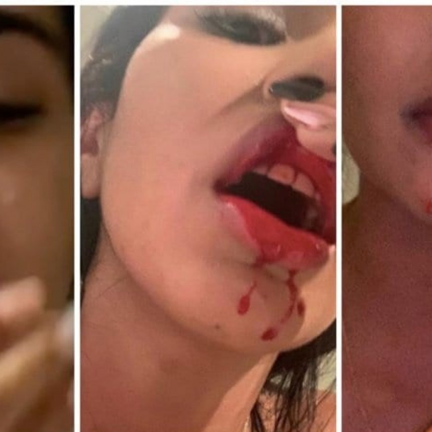 SORPRENDENTES DECLARACIONES DEL CHELO DELGADO MINIMIZANDO LA VIOLENCIA DE GENERO.