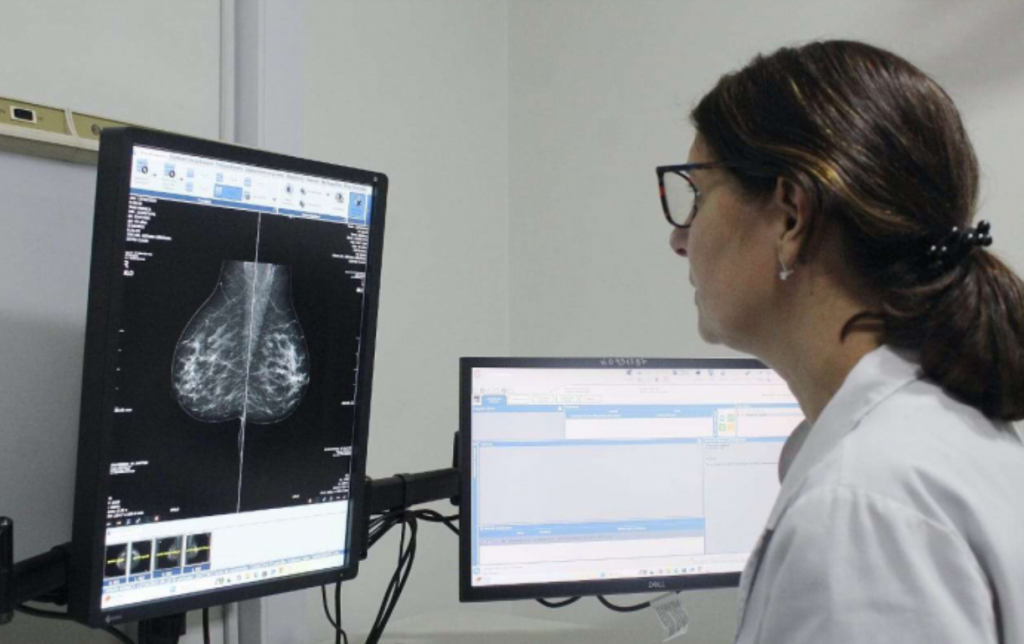  LA PROVINCIA DE BUENOS AIRES REDUCE A 40 AÑOS LA EDAD PARA REALIZAR LA PRIMERA MAMOGRAFÍA