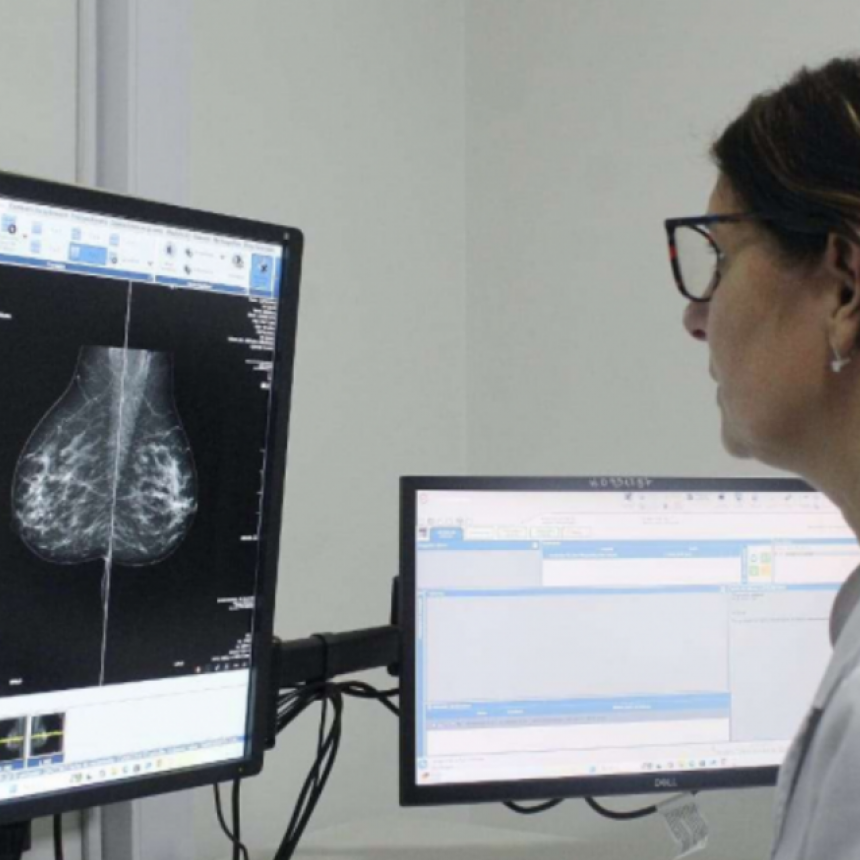  LA PROVINCIA DE BUENOS AIRES REDUCE A 40 AÑOS LA EDAD PARA REALIZAR LA PRIMERA MAMOGRAFÍA
