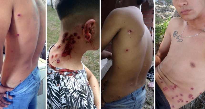EN ESCOBAR POLICÍAS DISPARARON EN UNA FIESTA CON BALAS DE GOMA: HERIDAS, UN AGENTE IMPUTADO Y 24 INVESTIGADOS