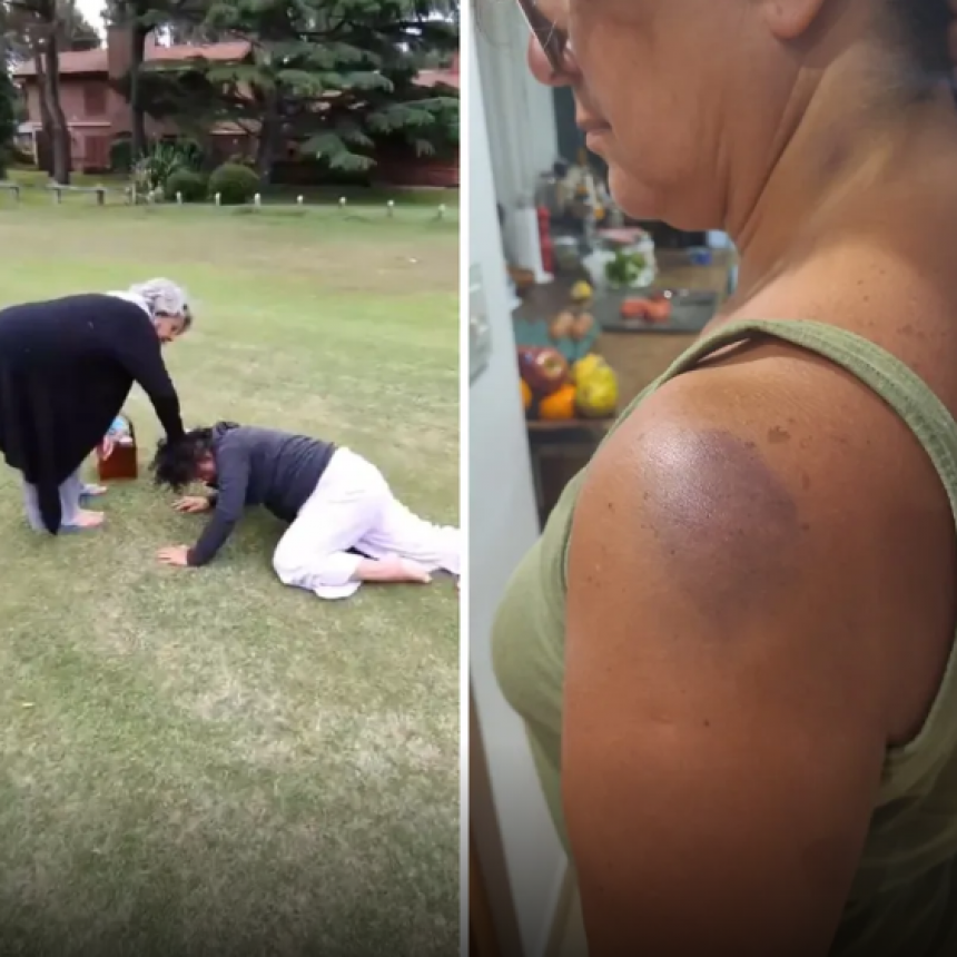 HABLÓ LA MUJER VÍCTIMA DE UN ATAQUE EXCLUSIVO GOLF DE PINAMAR: “ME PEGARON COMO A UNA RATA”